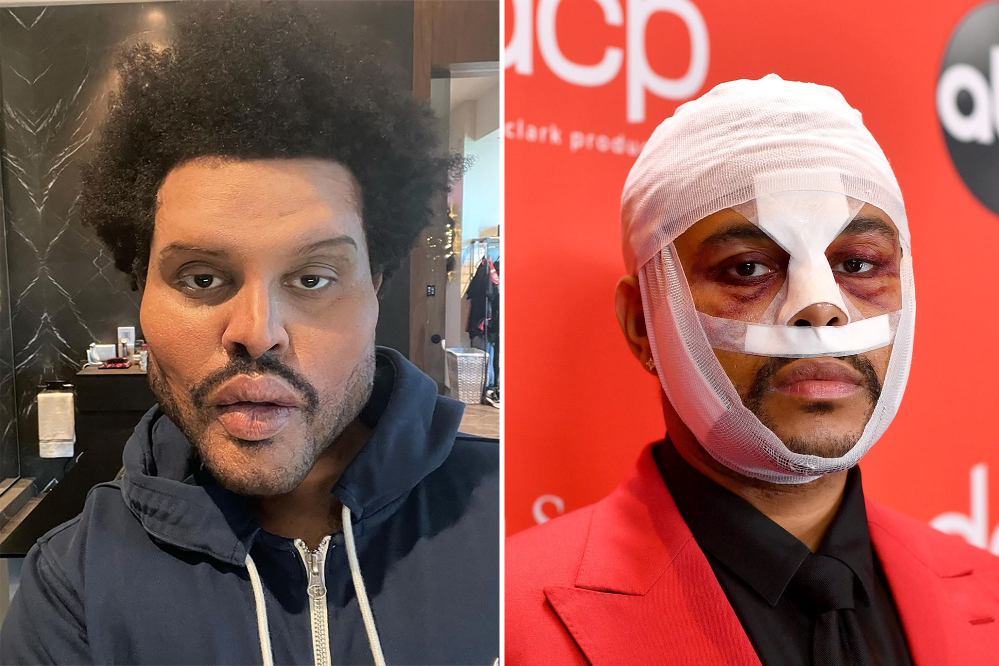 The weeknd фото до и после пластики What to know about The Weeknd ahead of Super Bowl 2021