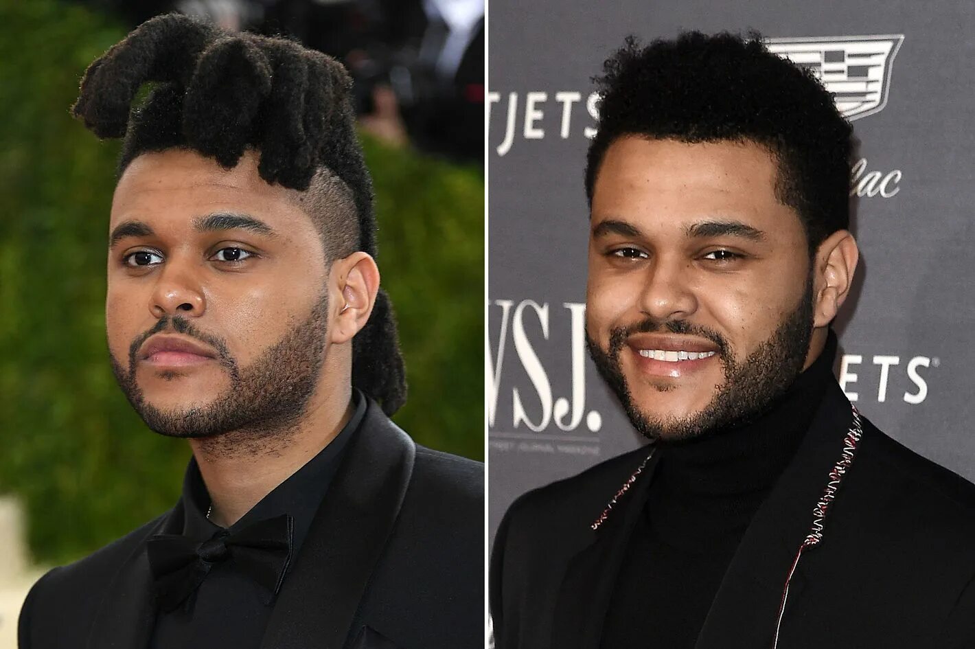 The weeknd фото до и после пластики The Weeknd Wig Outlet xn--h1aahyg1df.xn--p1ai
