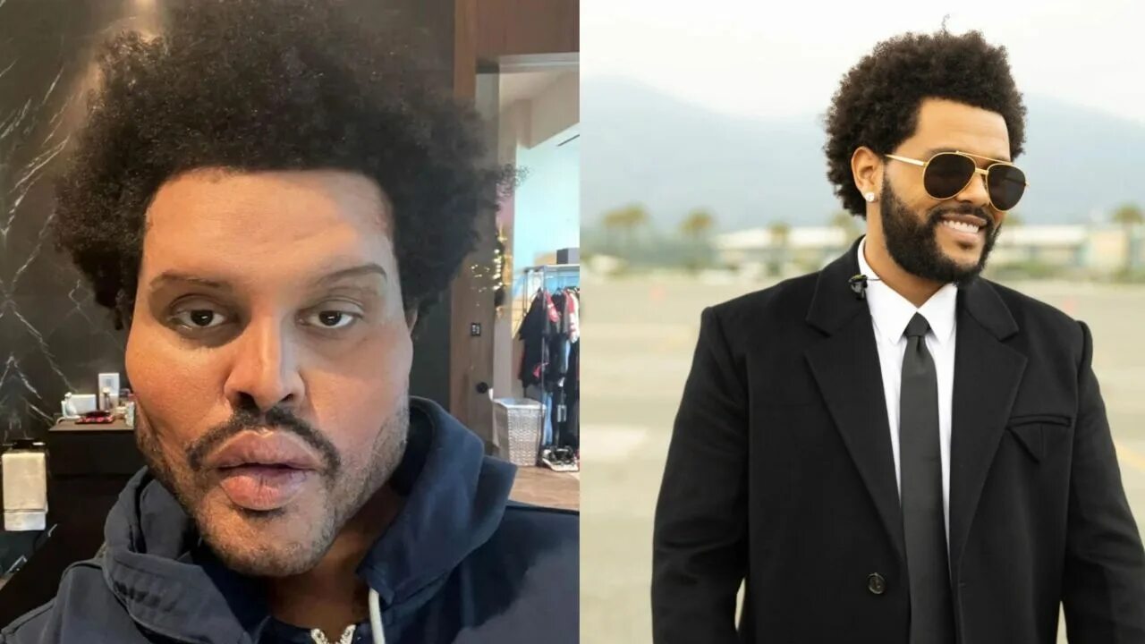 The weeknd фото до и после пластики The Weeknd’s Plastic Surgery Song: Did the Save Your Tears Singer Go Under the K