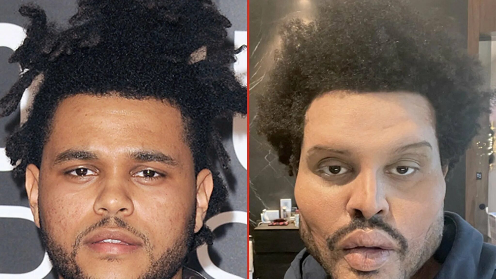 The weeknd фото до и после пластики The Weeknd -- Good Genes Or Good Docs?