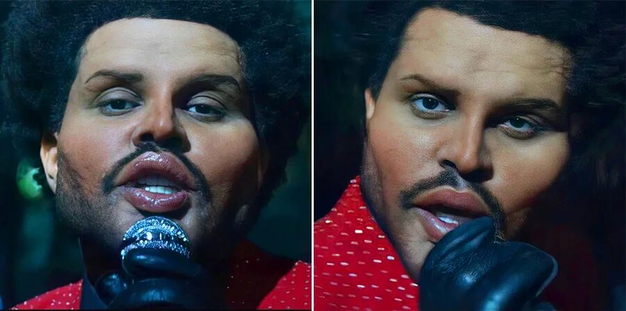 The weeknd фото до и после пластики Пластические операции певец