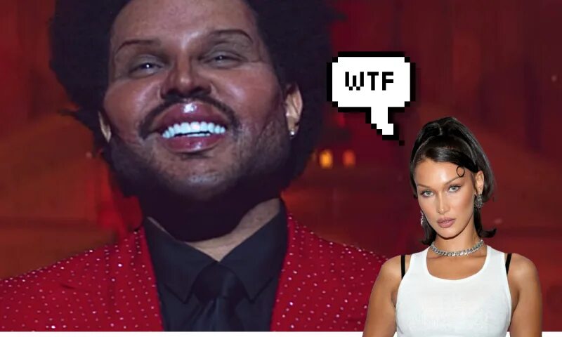 The weeknd фото до и после пластики Что за жуть? The Weeknd напугал фанатов новым лицом theGirl