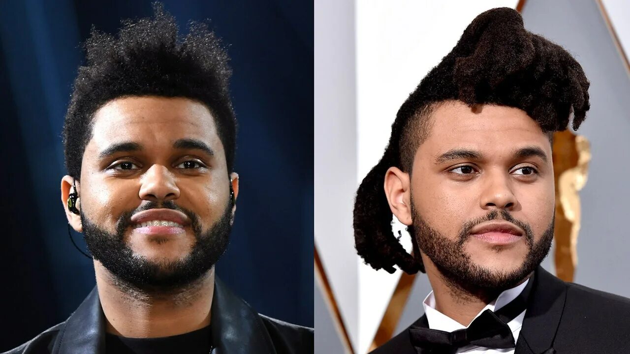 The weeknd фото после пластики Why The Weeknd Changed His Hair Vanity Fair
