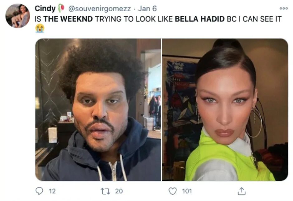 The weeknd фото после пластики The Weeknd gets his old face back for new Super Bowl commercial after fans shock