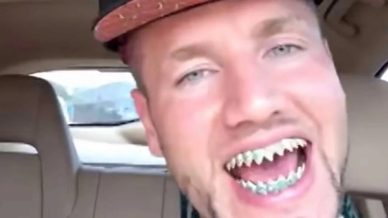 Акульи зубы у человека фото Get Shark Teeth Change the structure of your teeth to that of a shark - YouTube