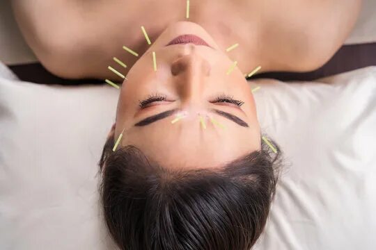 Акупунктура для лица фото до и после Facial Acupuncture Immagini - Sfoglia 3,481 foto, vettoriali e video Stock Adobe