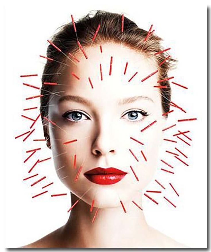 Акупунктура для лица фото до и после The Best Way To Feel Better With Acupuncture Acupuncture Tips