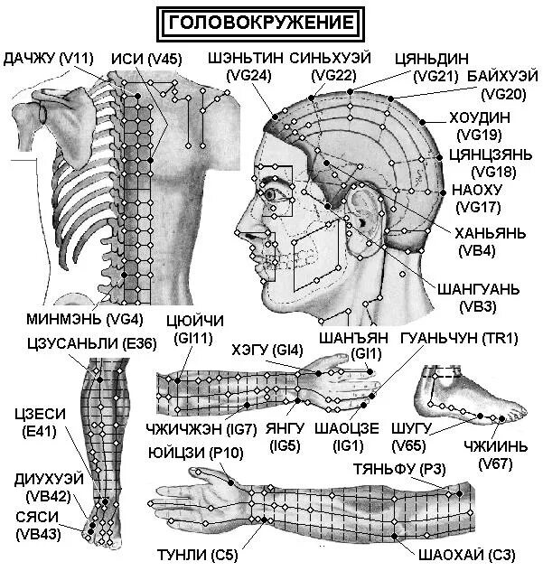 Акупунктурные точки фото и описание Головокружение -Неврозы, ангионеврозы- Электропунктура прибором Эледиа