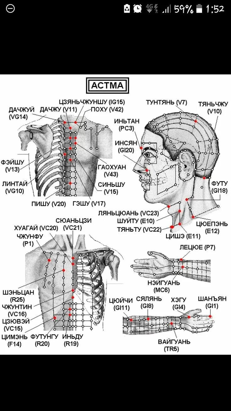Акупунктурные точки фото и описание Пин на доске Медицина