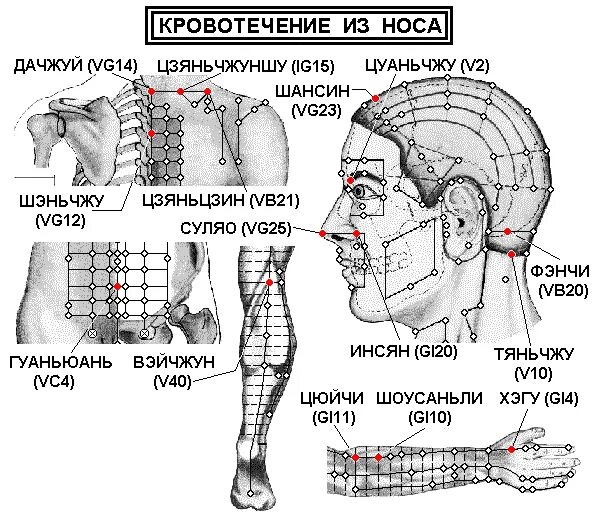 Акупунктурные точки фото и описание Кровотечение из носа -Заболевания ЛОР органов- Электропунктура прибором Эледиа