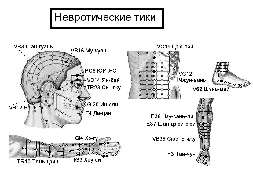 Акупунктурные точки фото и описание Невротические тики -Неврозы, ангионеврозы- Электропунктура прибором Эледиа