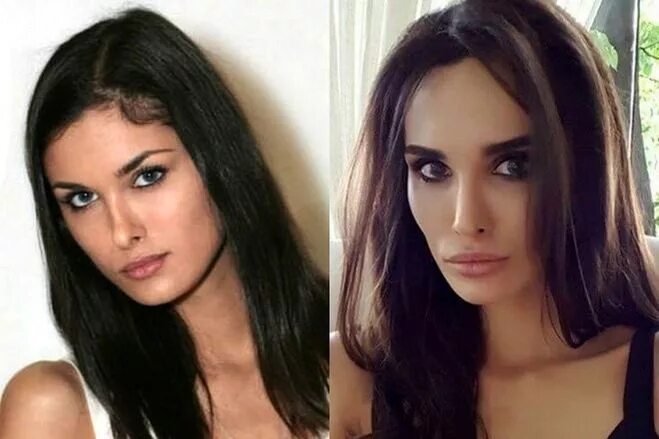 Алана мамаева до пластики и похудения фото Алана Мамаева кто это, какая биография, сколько лет, дети (см.