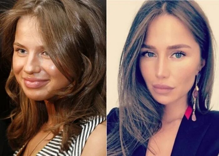 Алекса певица фото до и после пластики Пластические операции российских звезд: фото до и после