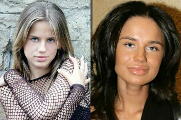 Алекса певица фото до и после пластики Российские звезды, которые изменили себя до неузнаваемости На Игле Дзен