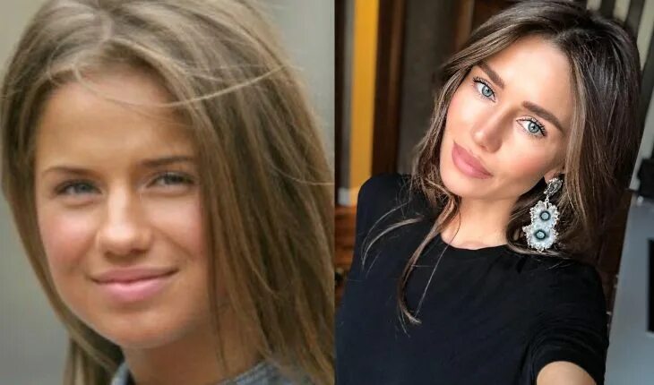 Алекса певица фото до и после пластики Звезда "Фабрики" Алекса после ринопластики стала неузнаваемой