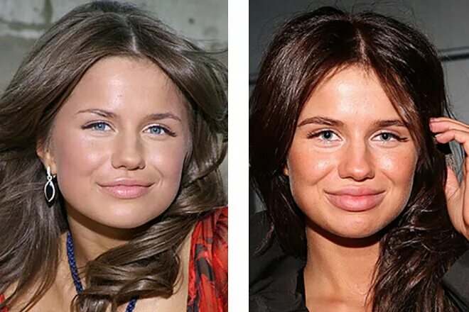 Алекса певица фото до и после пластики Звезды шоу бизнеса до и после пластической операции Всё о самом интересном! Дзен