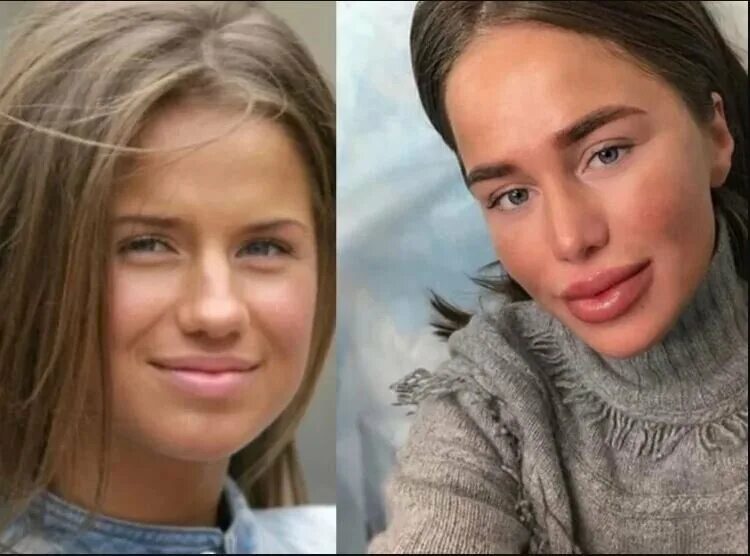 Алекса певица фото до и после пластики Алекса до и после: найдено 86 изображений
