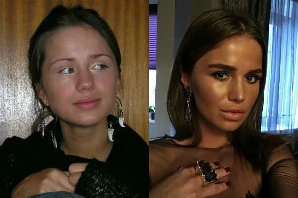 Алекса певица фото до и после пластики Алекса - певица до и после пластики губ и лица (Фото) Умница-Красавица