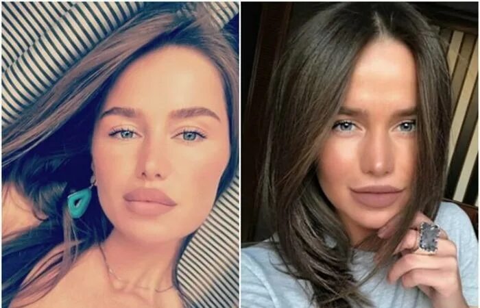 Алекса певица фото до и после пластики Пластика или фотошоп: звезды, которые стали похожи на мумий