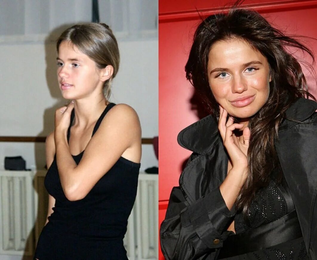 Алекса певица фото до и после пластики Алекса до и после пластики: найдено 88 изображений