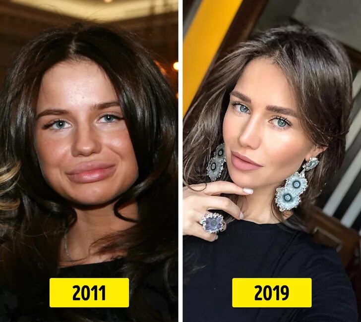 Алекса пластика фото Index of /wp-content/uploads/proga2018/images/201907
