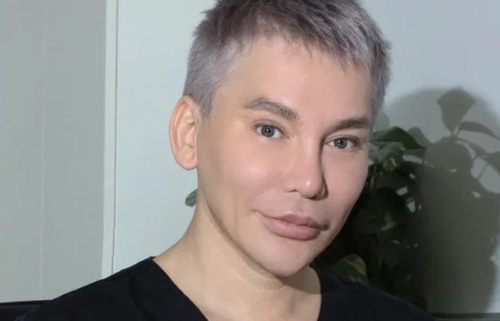 Александр вдовин до пластики фото Александр Вдовин пожаловался на проблемы со здоровьем
