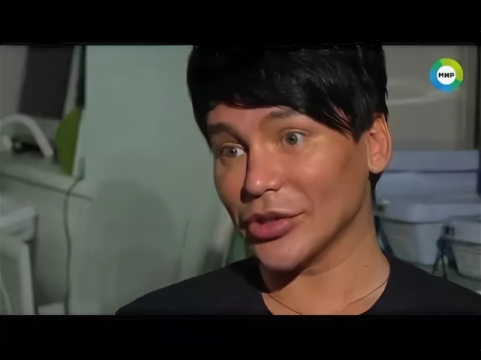 Александр вдовин до пластики фото пластический Доктор Алекс. "Другой мир" Продюсер и режиссер - Андрей Городнюк (VAVOVICH) - Yo
