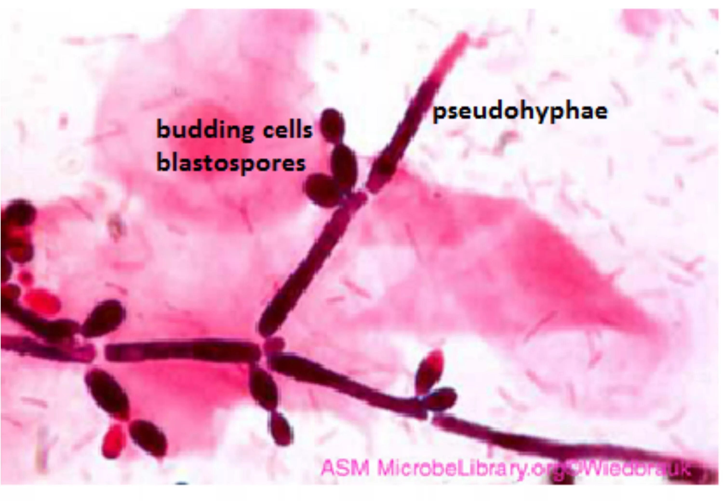 Кандидоз фото у женщин после 50 Pin on Medische Microbiologie/ Medical Microbiology