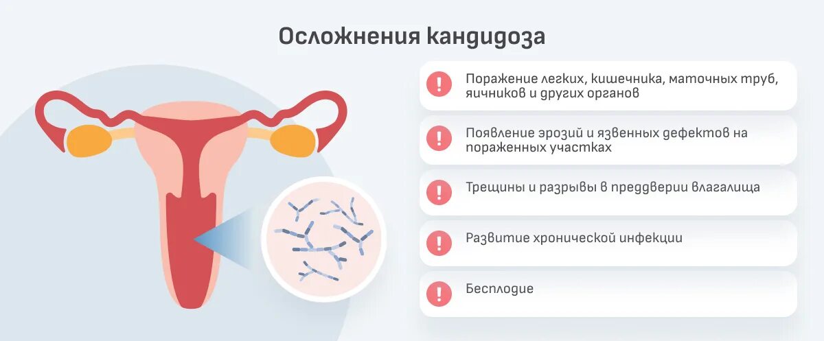 Кандидоз фото у женщин после 50 Кандидозы у женщин: симптомы, признаки и причины возникновения
