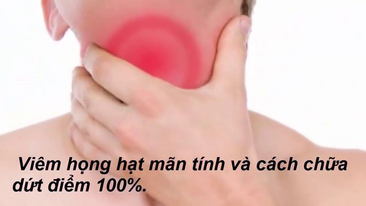 Кандидоз горла симптомы лечение фото Viêm họng hạt mãn tính: Phân biệt với viêm họng hạt cấp tính và cách điề... Hồng
