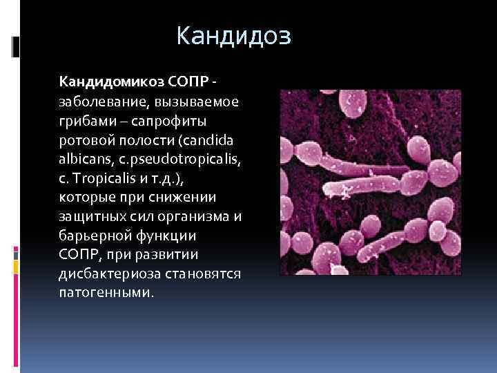 Кандидоз неба фото Кандидоз кишечника пошагово