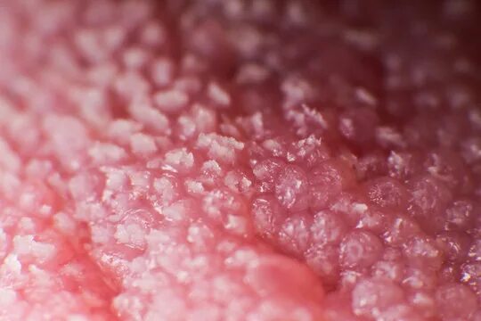 Кандидоз у мужчин симптомы фото "Candida Albicans" Изображения: просматривайте стоковые фотографии, векторные из