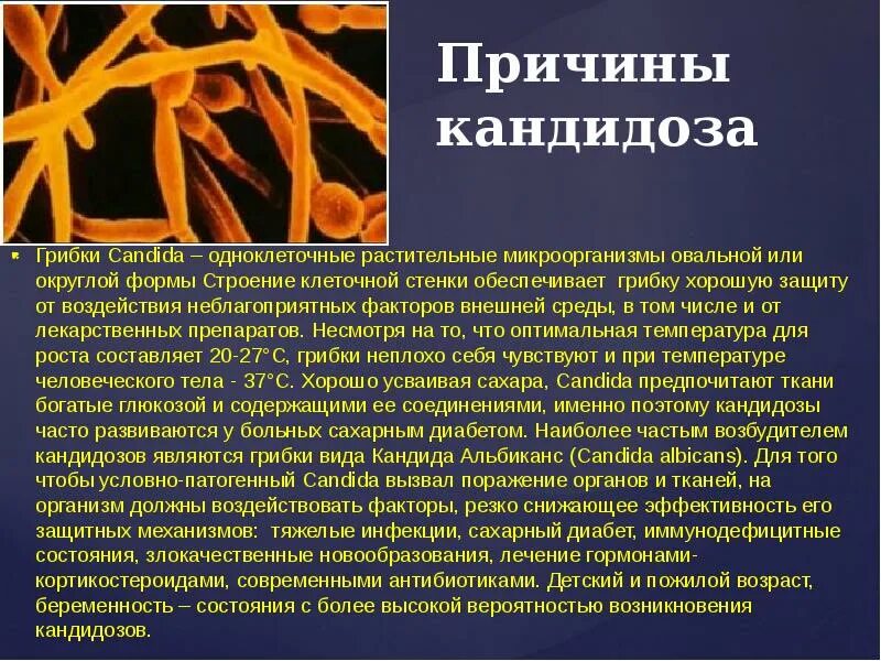 Кандидоз у мужчин симптомы фото Як і чим лікувати молочницю у жінок і чоловіків в домашніх умовах: симптоми, пре