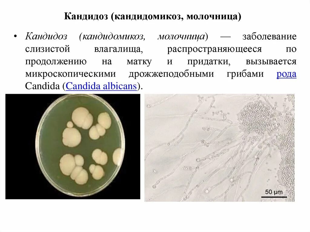 Кандидоз у женщин симптомы фото Что такое candida у женщин - найдено 84 картинок