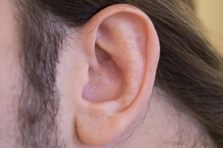 Кандидоз уха фото How to Unclog Ears From Congestion Naturally (With images) Unclog ears, Ear infe