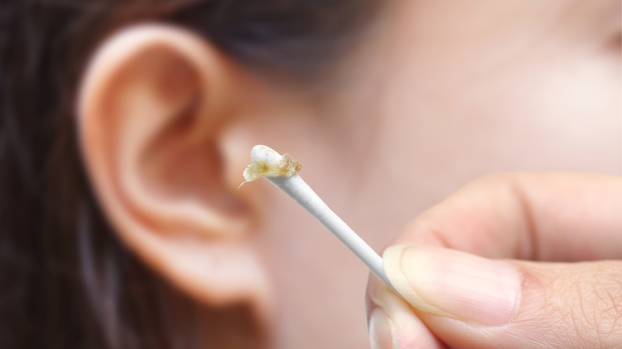 Кандидоз уха фото 4 reasons to put down the Q-tip and love your earwax Popular Science