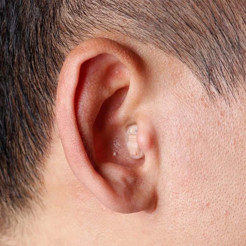 Кандидоз уха фото Acosound 210IF Mini Invisible CIC Hearing Aid Digital Hearing Aids For The Elder