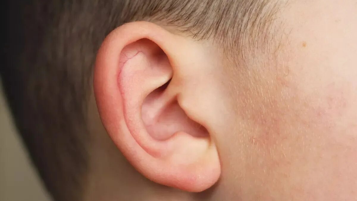 Кандидоз уха фото Lobe de l oreille - Lobe de loreille : tout savoir sur cette partie de loreille