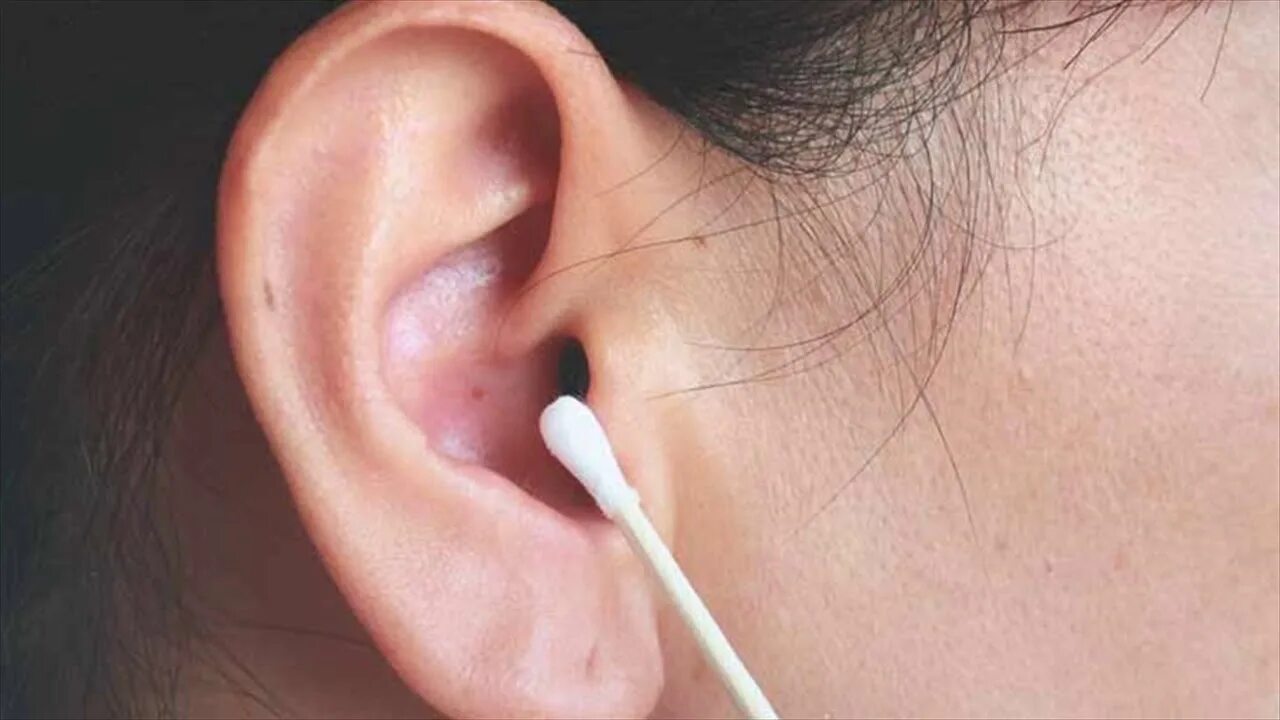 Кандидоз уха фото General Instructions After Ear Surgery - Follow Up Care After Ear Surgery - YouT