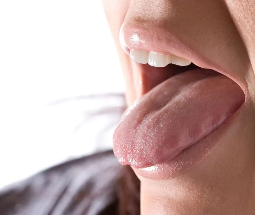 Кандидоз языка симптомы фото Blisters on the Tongue: Causes and Symptoms meridol ®