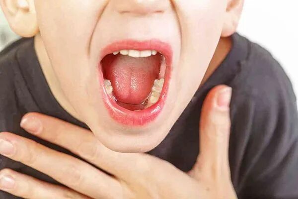 Кандидозная ангина фото горла Aparato digestivo para niños; Explicado paso a paso - El blog de tu bebe Bao