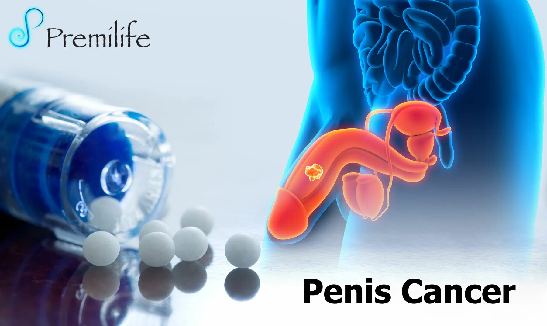 Кандидозный баланит у мужчин фото симптомы лечение Premature Ejaculation Neuroma Online poligraf-ti.kz