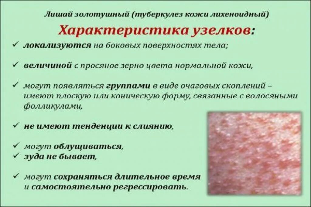 Кандидозный дерматит фото Лишил д: найдено 26 изображений