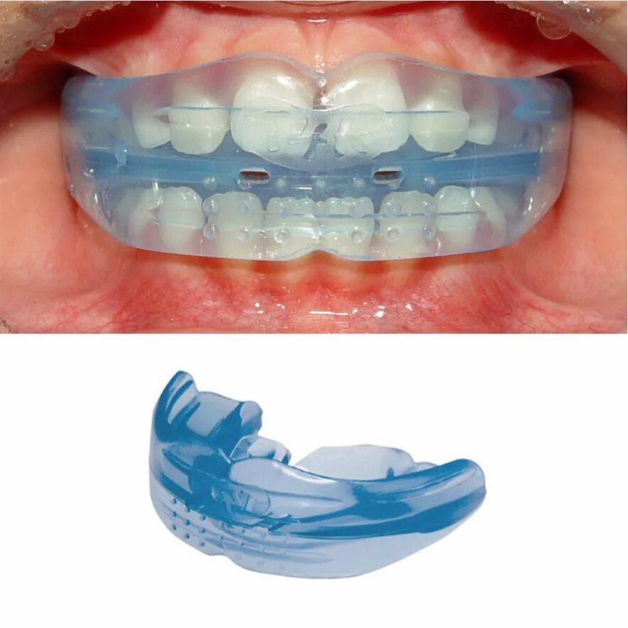 Кап для зубов фото Красивая улыбка ребёнка - забота любящих родителей :: NORD DENTAL - сеть клиник 