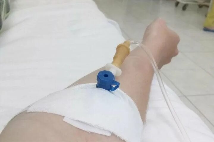Капельница рука девушки в больнице реальное фото "Ой, кажется, он сломался" - позиция Абаканского горсуда в истории со сломанным 