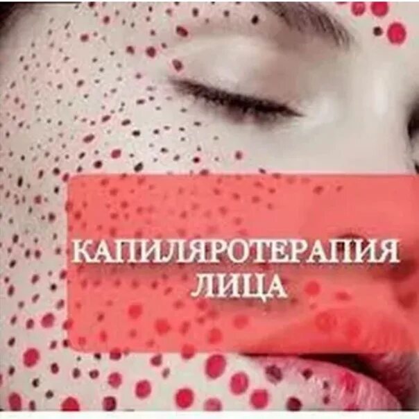 Капилляротерапия лица отзывы фото до и после Хиджама на лицо отзывы