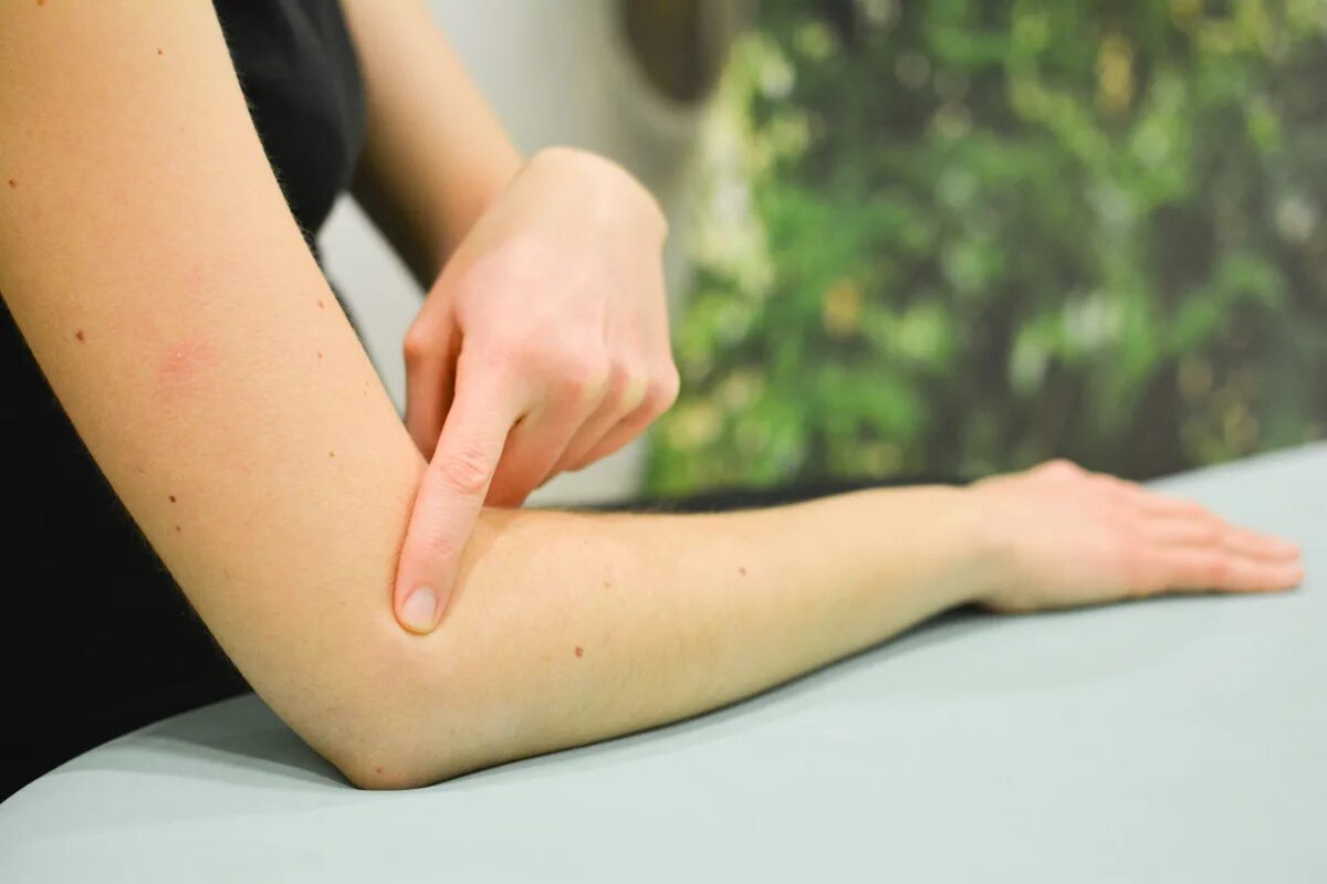 Каплевидный псориаз фото на теле симптомы masaje tendinitis brazo Gran venta - OFF 74