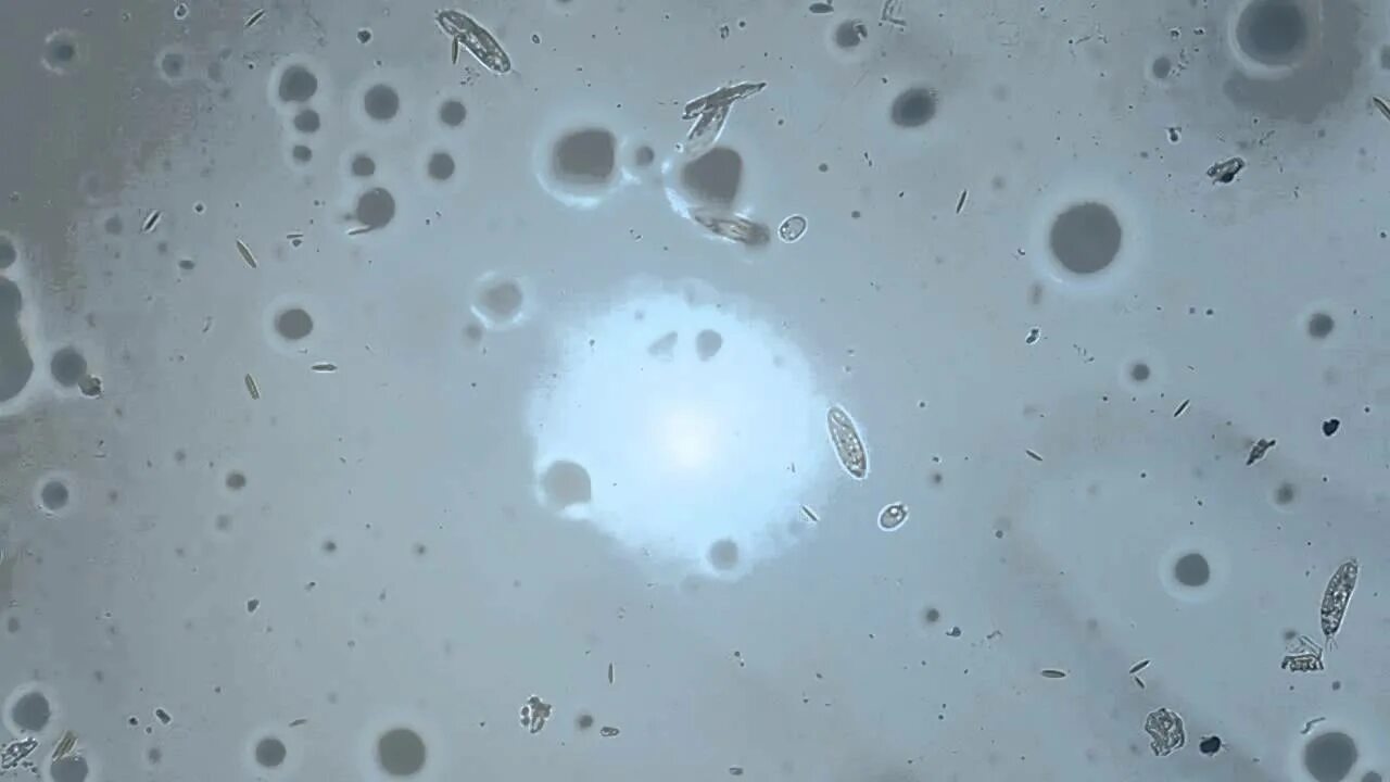 Капля воды под микроскопом фото Вода из аквариума под микроскопом. - YouTube