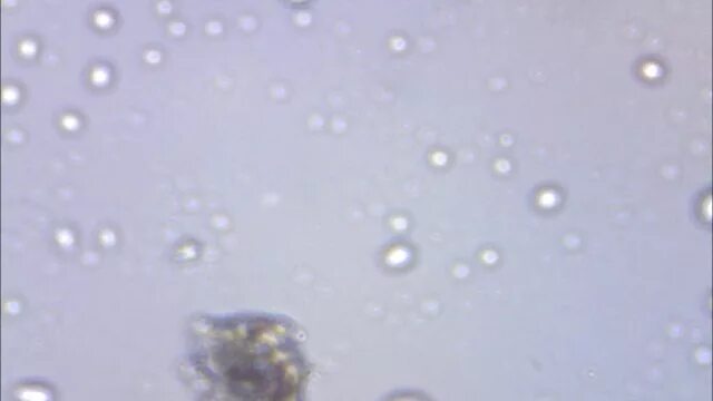 Капля воды под микроскопом фото Капля воды под микроскопом р. Кострома - смотреть видео онлайн от "Sveta_09" в х