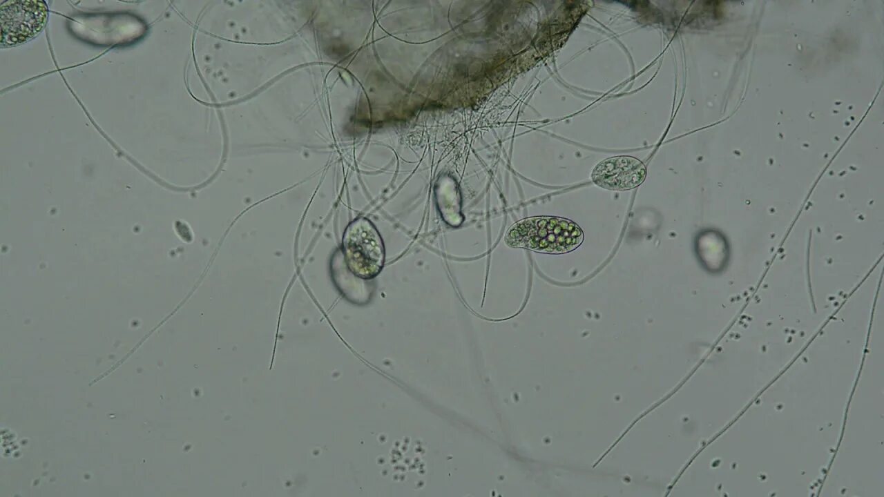 Капля воды под микроскопом фото DSC 8627 Вода под микроскопом - YouTube
